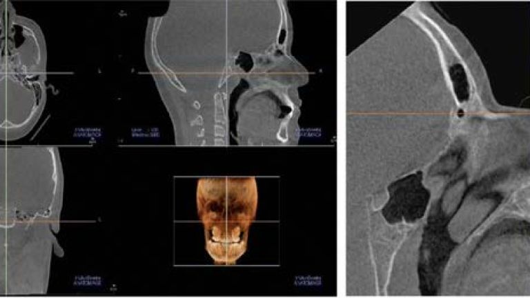 palate imaging