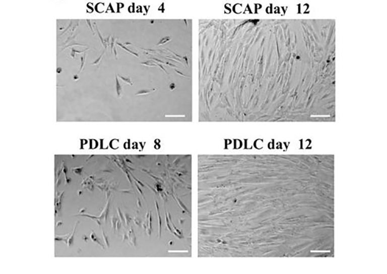 Generation of fibroblast colonies from single cells after 8 to 12 days of culture. Representative phase contrast microscopic photographs of generation and expansion of SCAP and PDLC. Cells have elongated shapes and grow attached to substrata. Scale bar, 25 μm.