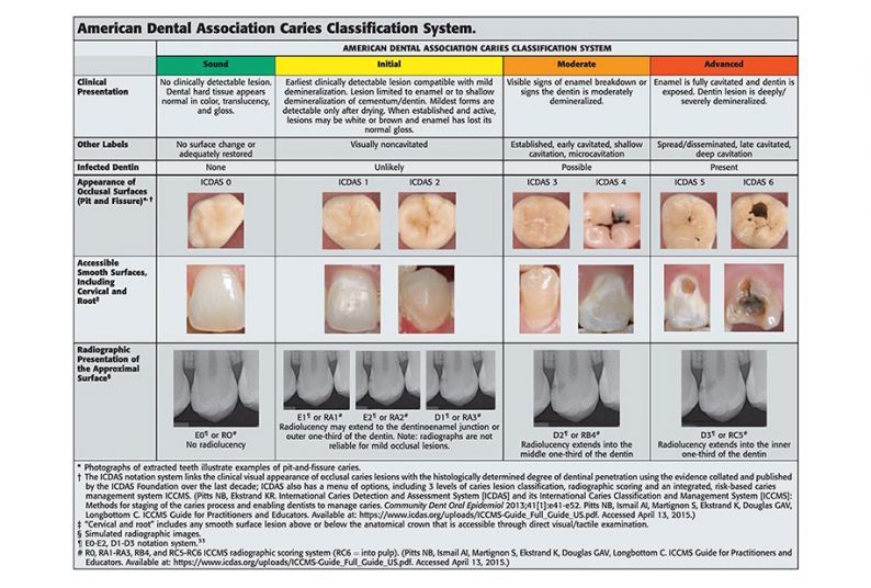 American Dental Association caries classification system.