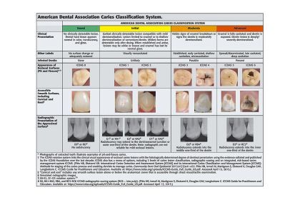 American Dental Association caries classification system.